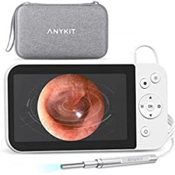 Digital Otoscope with 5" IPS Screen, 3.9mm Ear Camera with 6 Lights